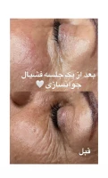 فیشال و پاکسازی تخصصی حنانه وقاری