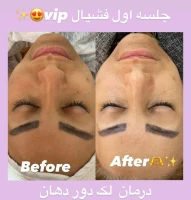 فیشال و پاکسازی تخصصی حنانه وقاری