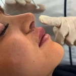 کلینیک پوست مو زیبایی زیما