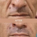 کلینیک زیبایی و لیزر مو دکتر سمانه وطن دوست