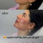 مرکز لیزر و کلینیک زیبایی پریفا