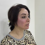 تصویر کلینیک زیبایی رز-دکتر رضوان موسوی