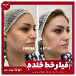 کلینیک تخصصی زیبایی و لیزر کوروش