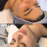 تصویر خدمات تخصصی فیشال و پاکسازی پوست حفظی