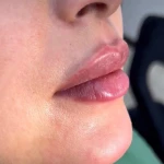 لوگوی مرکز زیبایی ویتا
