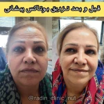  مرکز لیزر و کلینیک زیبایی و لاغری رادین