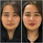 مطب زیبایی لیانارخ