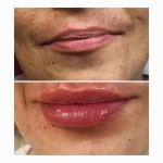کلینیک تخصصی پوست،مو،زیبایی،لیزر لاولی
