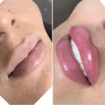 کلینیک پوست مو زیبایی و لیزر سارا