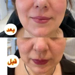 مرکز پوست مو زیبایی رز طلایی