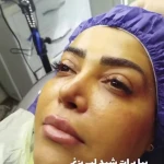 خدمات فوق تخصصی پوست مژگان صالحی