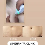 کلینیک  لیزر موهای زائد و زیبایی مهرنیا