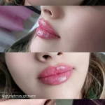 کلینیک زیبایی و لیزر موژان