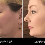 کلینیک لیزر ،ژل ،بوتاکس و لاغری ویتالایف
