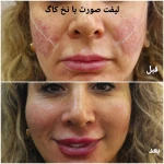 کلینیک زیبایی و لیزر مو گندم