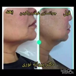 کلینیک زیبایی مرکز لیزر دکترپروانه نوری