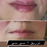 کلینیک زیبایی لوندر( لیزر موهای زائد)