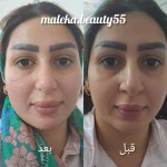 فشیال پاکسازی تخصصی ملکیا سلیمی