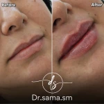 مطب پوست و مو زیبایی دکتر سما