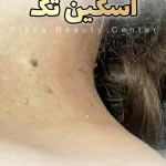  مطب پوست و زیبایی و لیزر پلازا