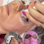  مرکز تخصصی پاکسازی پوست بنوشه
