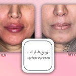  کلینیک زیبایی دکتر پوروزیری