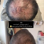 تصویر پاکسازی پوست(فیشال) و خدمات مو مرجان آرا