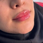 مرکز لیزر و زیبایی نویامِد