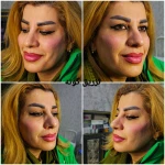 کلینیک زیبایی و لیزر مو گندم
