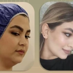 کلینیک پوست مو زیبایی حضور