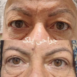 کلینیک زیبایی پوست و لیزر ایده آل