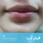 مركز ليزر و لاغري آيسان