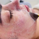 فیشیال پوست با سحر