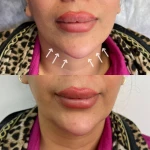 نمونه کار کلینیک زیبایی مهراز