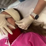 نمونه کار فیشال و پاکسازی تخصصی پوست سارا جلالی