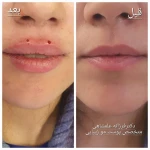 متخصص پوست مو زیبایی لیزر دکتر فرزانه علمشاهی