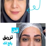 تصویر کلینیک تخصصی پوست و زیبایی ملینا