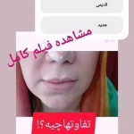 دکتر زیبایی بوتاکس دکتر شیرین امیر حسنی