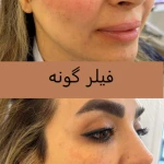 کلینیک پوست مو لیزر لاغری زیباریس