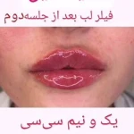 دکتر زیبایی بوتاکس دکتر شیرین امیر حسنی