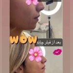 نمونه کار کلینیک زیبایی دلا