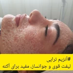 فیشال و مراقبتهای تخصصی پوست