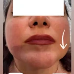 نمونه کار دکتر مینو مومنی