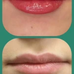 تصویر کلینیک لیزر و جراحی مینوسا