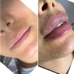 کلینیک پوست مو زیبایی و لیزر سارا