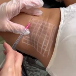 مرکز لیزرو پوست و طب سوزنی الماس تابان