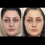 کلینیک زیبایی و لیزر سپیداسکین در تهران