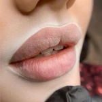 مرکز پوست، زیبایی و لیزر نکو