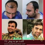 نمونه کار کلینیک تخصصی پوست و مو و زیبایی آسیا کلینیک