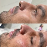 مرکز لیزر و زیبایی هانیسا